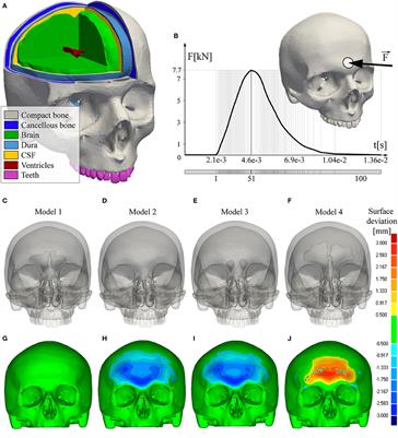 Trauma of the Frontal Region Is Influenced by the Volume of Frontal Sinuses. A Finite Element Study